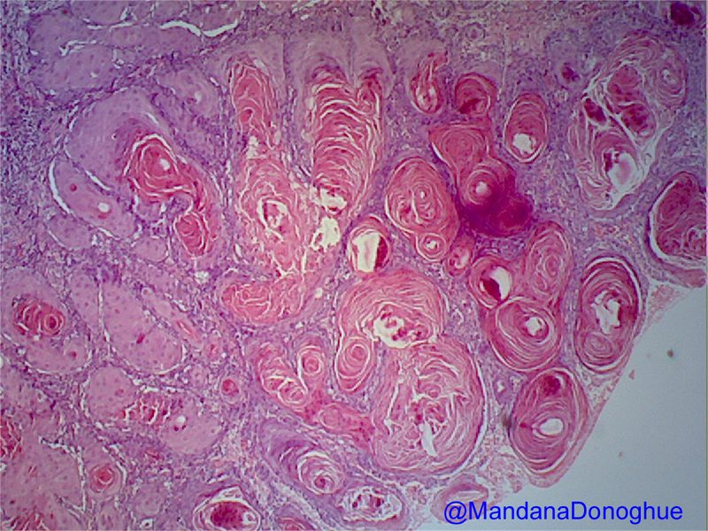 Estructura molecular de la curcumina